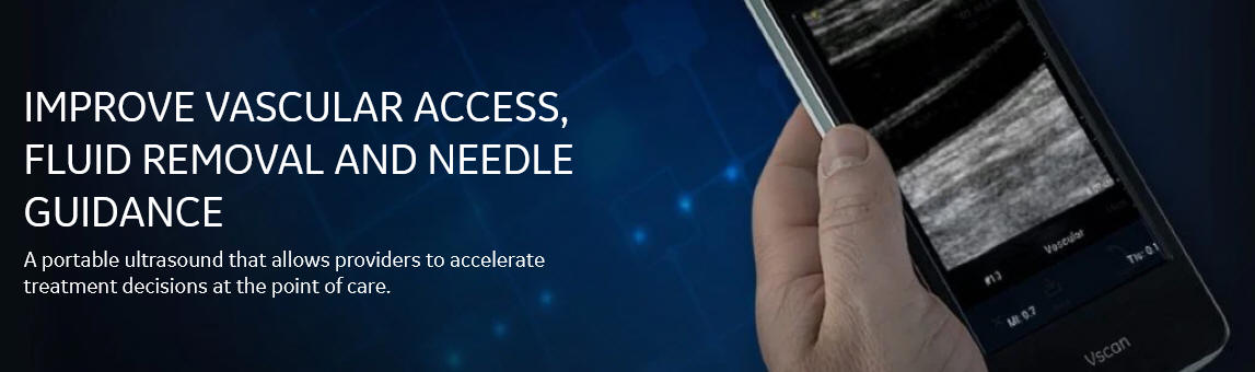 GE General Procedural Handheld Ultrasound Vscan Raleigh Durham Chapel Hill Douglas Hartley   