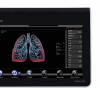 Bellavista Ventilator by Vyaire Medical Raleigh Dureham   