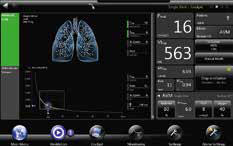 Bellavista Ventilator by Vyaire Medical Raleigh Durham   AVM    